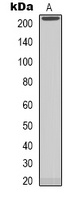 Anti-NAV1 Antibody
