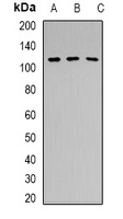 PRPF6 antibody