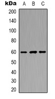 Anti-POTEB Antibody