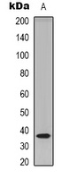 TECR antibody