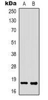 Anti-FAT10 Antibody