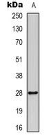 14-3-3-pan (AcK51/49) antibody