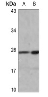Anti-HMGB1 (Acetyl-K12) Antibody