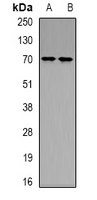 Ku70 (AcK539) antibody