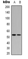Anti-p53 (Acetyl-K370) Antibody