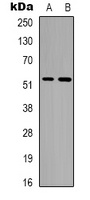 Alpha-tubulin (AcK352) antibody