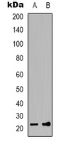 FGF12 antibody