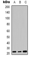 Anti-FGF20 Antibody