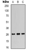 Anti-FGF18 Antibody