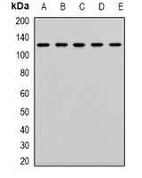 Anti-CD133 Antibody