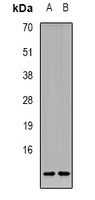 CCL11 antibody