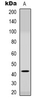 Anti-CCR6 Antibody
