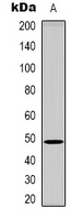 Anti-CD158e Antibody