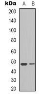 VEGFC antibody