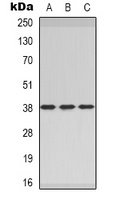 Anti-CER1 Antibody