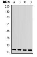 Anti-IL-1F10 Antibody