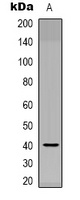 NODAL antibody