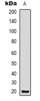 Anti-CMTM8 Antibody