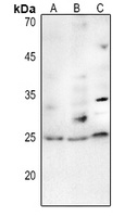 TP53INP2 antibody