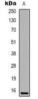 Anti-IFITM2 Antibody