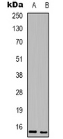Anti-BATF3 Antibody