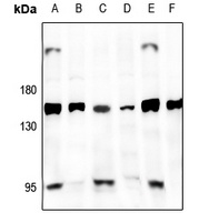 GPR126 antibody