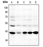 GPR87 antibody