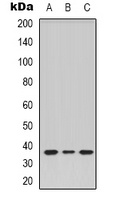 Anti-TRB1 Antibody