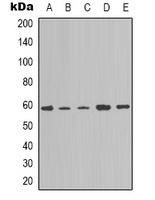 Anti-NOTCH4 Antibody