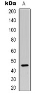 Anti-Plasma Kallikrein HC Antibody