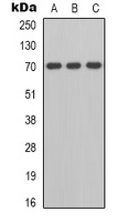 Anti-ZAP70 Antibody