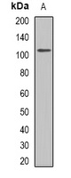 Anti-GLUR1 Antibody