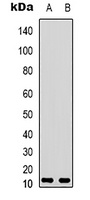 Anti-VIP Antibody