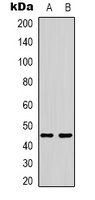 IHH antibody