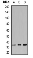 CDC34 antibody