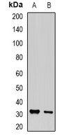 Anti-PA28 gamma Antibody