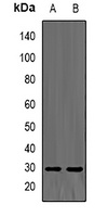 Anti-TPMT Antibody