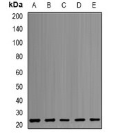 PSMB1 antibody