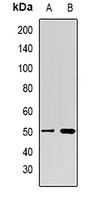 PSMD4 antibody