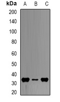 HADH antibody