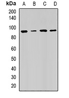 Anti-RRM1 Antibody