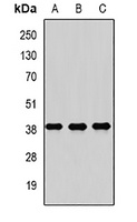 Anti-RASSF1 Antibody