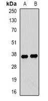 TPM3 antibody