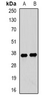 Anti-Tropomyosin 3 Antibody