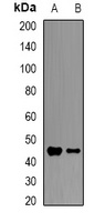 Anti-HFE Antibody