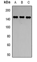 TLR8 antibody