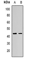 Anti-AdipoR1 Antibody