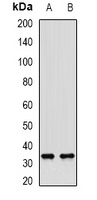 SULT1A1 antibody