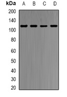 Anti-HMGCR Antibody