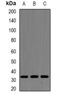 SRSF1 antibody